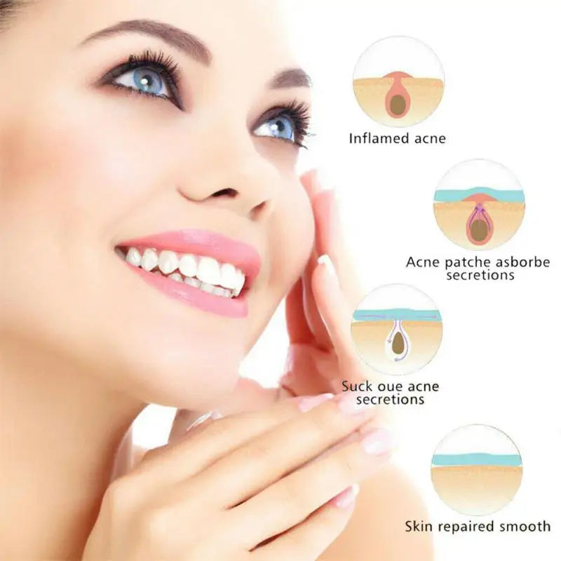 36 Pimple Patch Acne Treatment Invisible Spot Cover Absorbs Oil & Reduces Redness
