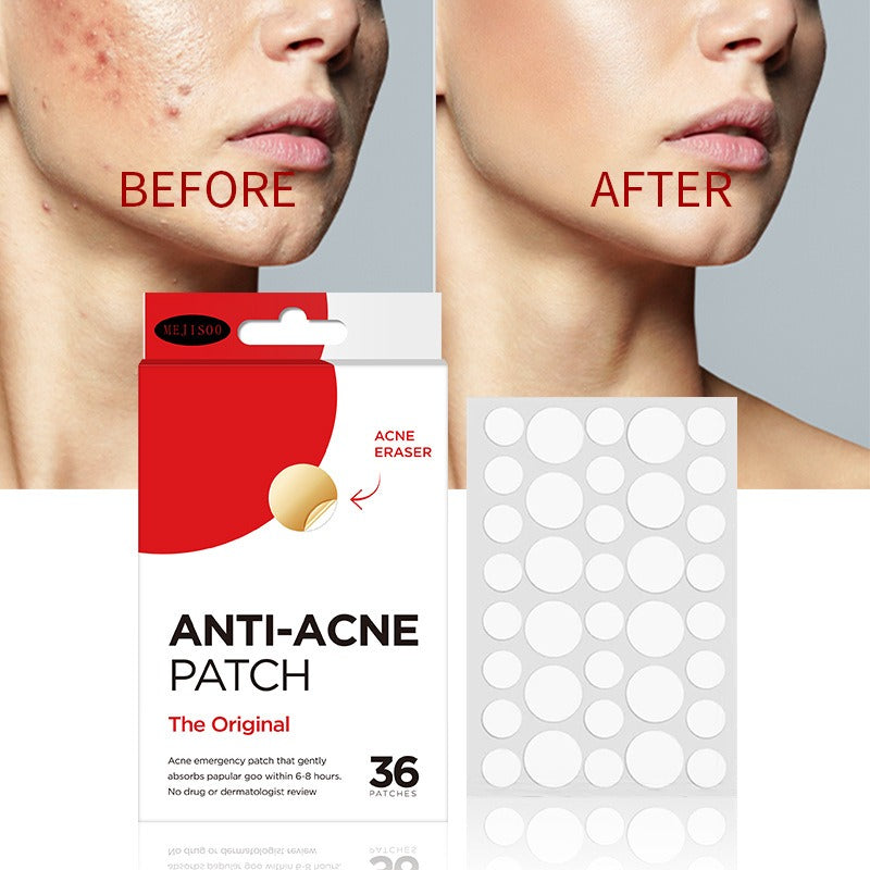 Acne Patch 36 Patches Hydrocolloid Invisible Healing for Spot Spots Treatment